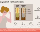 Ilustracja pokazuje porównanie zdrowych i uszkodzonych włosów, podkreślając łamliwość włosów i inne problemy.